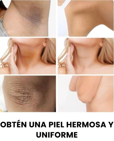 CREMA BLANQUEADORA INTIMA