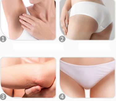 CREMA BLANQUEADORA INTIMA