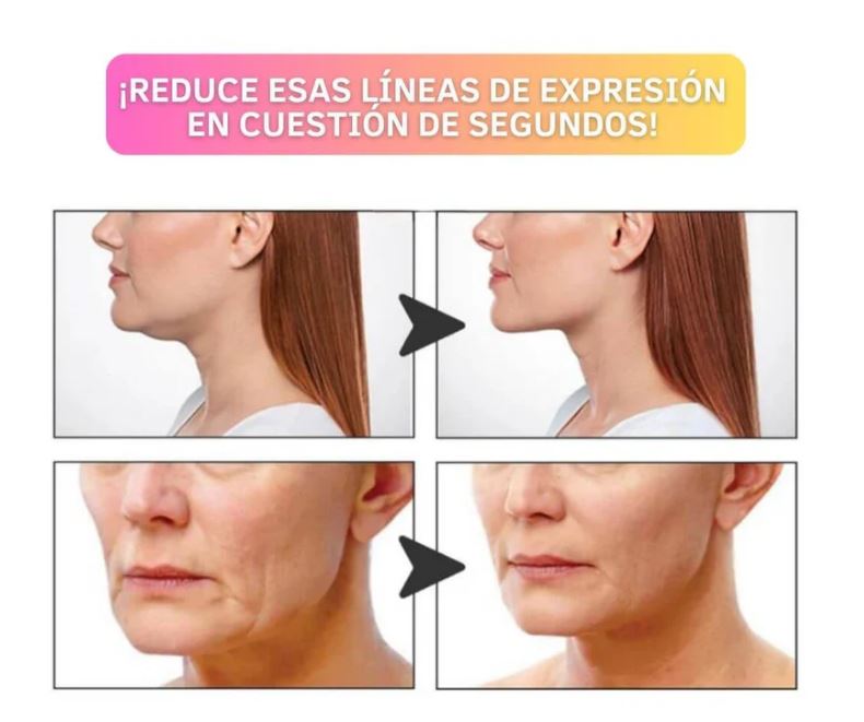 Secret Lift™ - Parches Lifting Faciales (40 piezas)