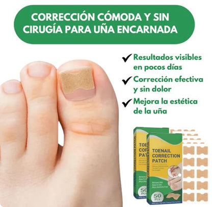 PediPatch® - 50 Parches Para Uñas Encarnadas
