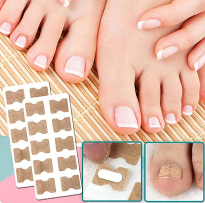 PediPatch® - 50 Parches Para Uñas Encarnadas
