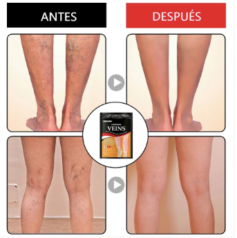 ¡Varicose! Pack 24 Parches Elimina Varices